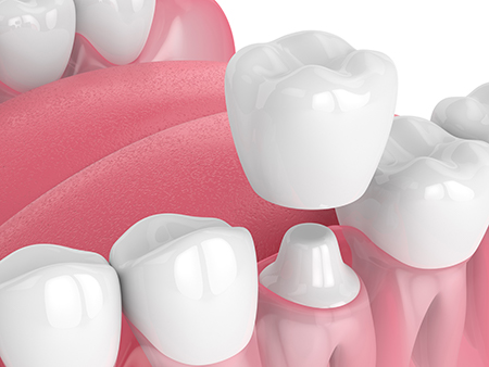 Dental Excellence Integrative Center