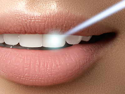 Dental Excellence Integrative Center